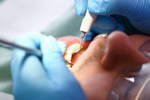 Best Emergency Dental Surgery in Harrison, MI